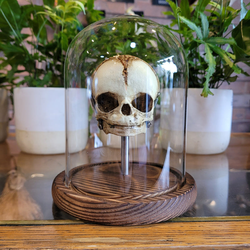 Human Fetal Skull Model with Cloche