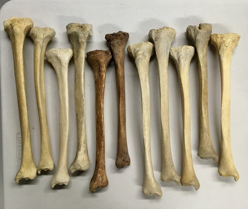 Human Tibia Leg Bone