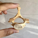 Human Cervical Vertebra