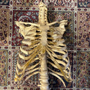 Incomplete Human Skeleton