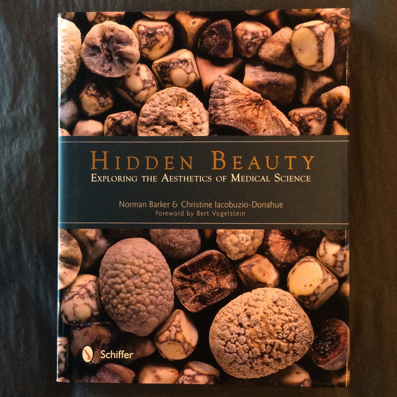 Hidden Beauty: Exploring the Aesthetics of Medical Science by Norman Baker & Christine Iacobuzio-Donahue