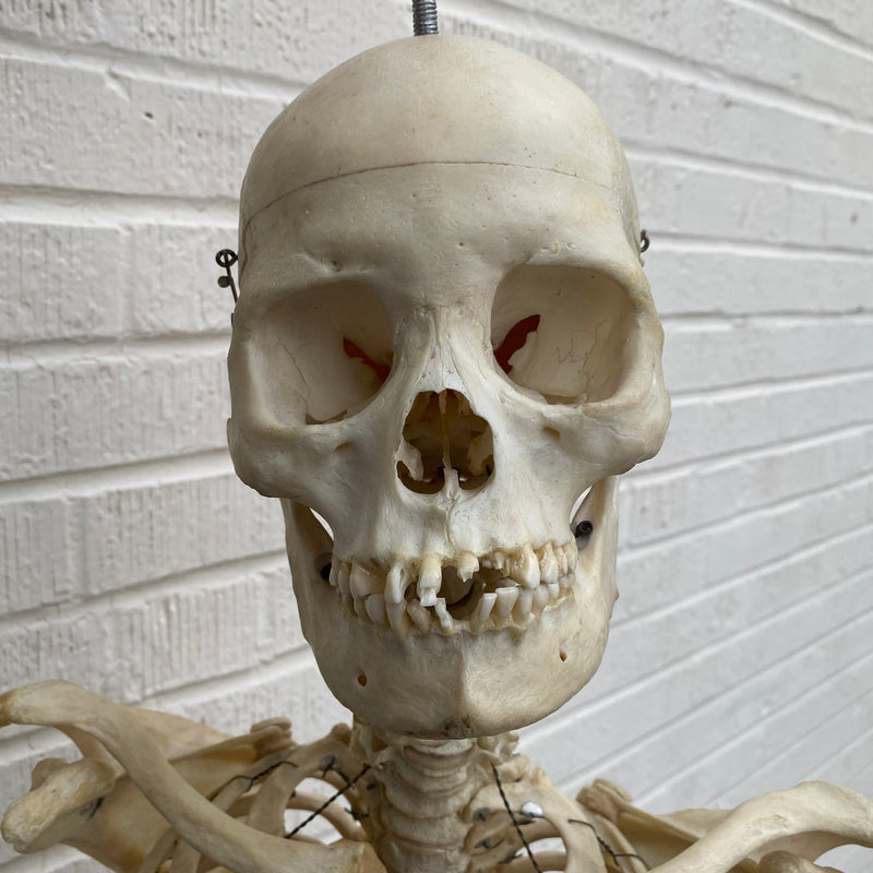 Partial Human Skeleton