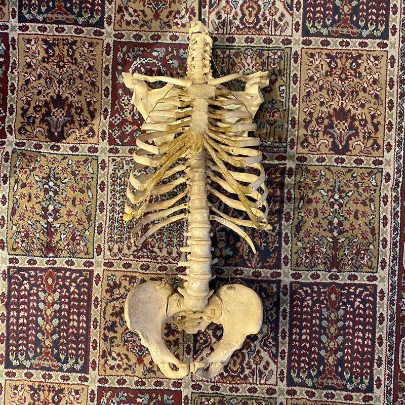 Incomplete Human Skeleton