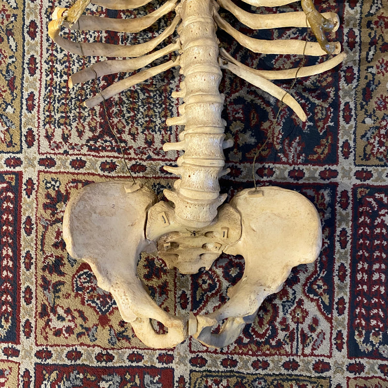 Incomplete Human Skeleton