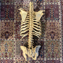 Incomplete Human Skeleton