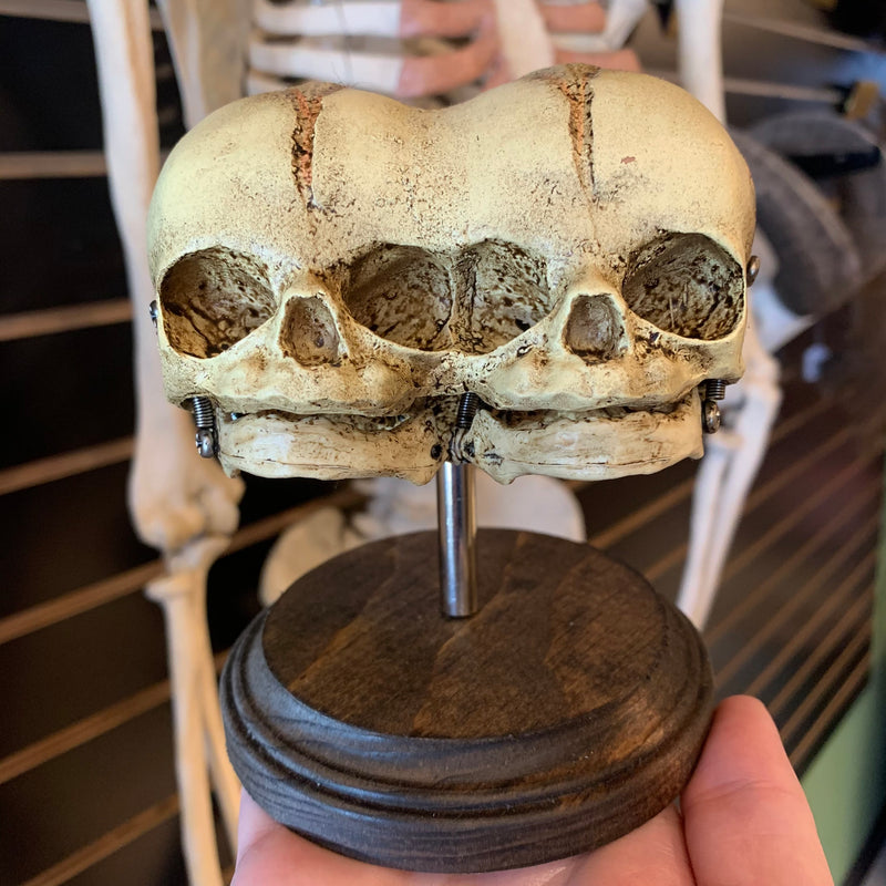 Triclops Conjoined Twin 3-Eyed Skull Model