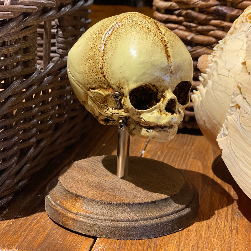 Human Fetal Skull Model