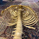 Incomplete Human Skeleton