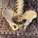 Incomplete Human Skeleton